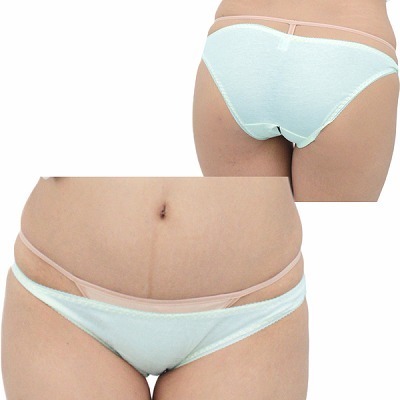 �����W�F���[�b�L�k�����Q�R�b�g���ҊJ���t���o�b�N�@�T�b�N�X