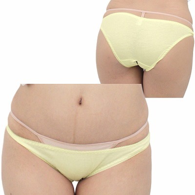 �����W�F���[�b�L�k�����Q�R�b�g���ҊJ���t���o�b�N�@�C�G���[